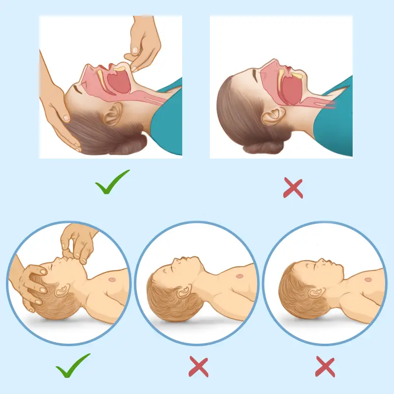 Airway